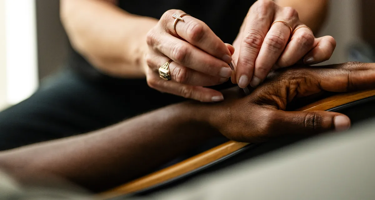 An image of a woman receiving acupuncture at the YMCA